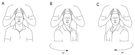 clinical neck torsion nystagmus test|Normative Responses to Clinical Tests for Cervicogenic Dizziness .